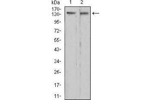 Western blot analysis using RAD50 mouse mAb against C6 (1) and HepG2 (2) cell lysate. (RAD50 antibody  (AA 228-359))