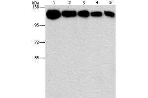 Western Blot analysis of A431, K562, 231, hela and hepG2 cell using HK2 Polyclonal Antibody at dilution of 1:1200 (Hexokinase 2 antibody)