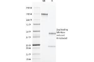 SDS-PAGE Analysis Purified TGF alpha Mouse Monoclonal Antibody (MF9). (TGFA antibody  (C-Term))