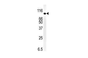 Western blot analysis of anti-SMURF1 Pab (ABIN388828 and ABIN2850430) in mouse kidney tissue lysate (35 μg/lane).