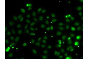 Immunofluorescence analysis of MCF-7 cells using NGFRAP1 antibody (ABIN5974398). (Nerve Growth Factor Receptor (TNFRSF16) Associated Protein 1 (NGFRAP1) antibody)