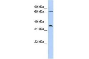 Image no. 1 for anti-Chemokine (C-C Motif) Receptor 4 (CCR4) (AA 180-229) antibody (ABIN6741489) (CCR4 antibody  (AA 180-229))