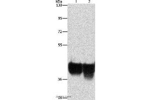 Western blot analysis of Hela and 293T cell, using AUP1 Polyclonal Antibody at dilution of 1:500 (Ancient Ubiquitous Protein 1 antibody)
