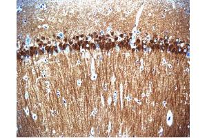 Immunohistochemical staining of pyrimidal cells in the rat hippocampus, formalin-fixed paraffin-embedded tissue section with no pre-treatment (20X magnification).