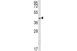 Western Blotting (WB) image for anti-Major Histocompatibility Complex, Class I, B (HLA-B) antibody (ABIN3003834) (HLA-B antibody)