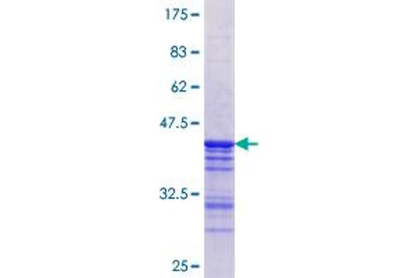 STK3 Protein (AA 253-350) (GST tag)