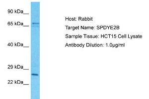 Host: Rabbit Target Name: SPDYE2B Sample Tissue: Human HCT15 Whole Cell Antibody Dilution: 1ug/ml (SPDYE2B antibody  (C-Term))