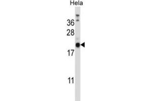 Western Blotting (WB) image for anti-Proline Rich Gla (G-Carboxyglutamic Acid) 1 (PRRG1) antibody (ABIN2997291)