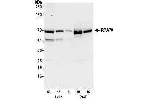 Western Blotting (WB) image for anti-Replication Protein A1, 70kDa (RPA1) (AA 350-400) antibody (ABIN7453556) (RPA1 antibody  (AA 350-400))