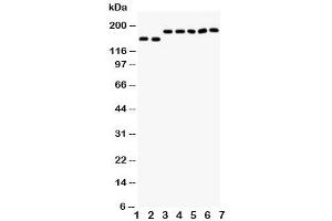 Western blot testing of DCC antibody and Lane 1:  rat brain (DCC antibody  (AA 162-178))