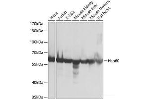Western blot analysis of extracts of various cell lines using Hsp60 Polyclonal Antibody at dilution of 1:1000. (HSPD1 antibody)