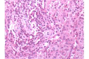 Human Spleen: Formalin-Fixed, Paraffin-Embedded (FFPE) (CXCR3 antibody  (C-Term))