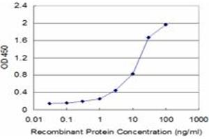 Detection limit for recombinant GST tagged STK17A is approximately 1ng/ml as a capture antibody. (STK17A antibody  (AA 301-413))