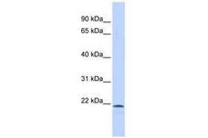 Image no. 1 for anti-Sex Comb On Midleg-Like 1 (SCML1) (N-Term) antibody (ABIN6740560) (SCML1 antibody  (N-Term))