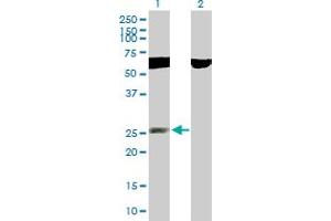 Western Blot analysis of RNF141 expression in transfected 293T cell line by RNF141 MaxPab polyclonal antibody.
