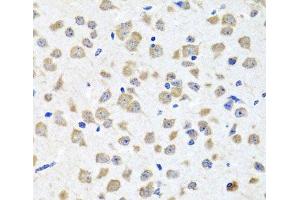 Immunohistochemistry of paraffin-embedded Mouse brain using PIP4K2B Polyclonal Antibody at dilution of 1:100 (40x lens). (PIP4K2B antibody)