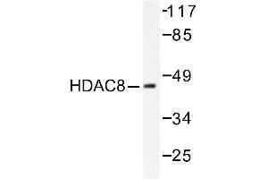 Image no. 1 for anti-Histone Deacetylase 8 (HDAC8) antibody (ABIN265460) (HDAC8 antibody)