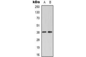 Western blot analysis of GRAP2 expression in K562 (A), Jurkat (B) whole cell lysates. (GRAP2 antibody)