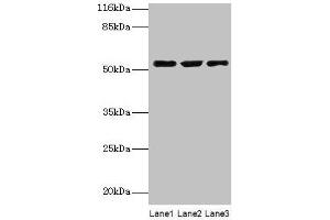Western blot All lanes: CRNN antibody at 12 μg/mL Lane 1: HepG2 whole cell lysate Lane 2: Mouse heart tissue Lane 3: Rat skeletal muscle tissue Secondary Goat polyclonal to rabbit IgG at 1/10000 dilution Predicted band size: 54 kDa Observed band size: 54 kDa (CRNN antibody  (AA 139-389))
