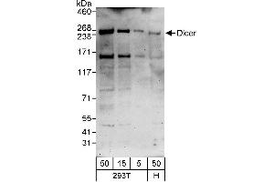 Western Blotting (WB) image for anti-Dicer 1, Ribonuclease Type III (DICER1) (AA 1175-1225) antibody (ABIN7452753)