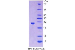 SDS-PAGE (SDS) image for Wingless-Type MMTV Integration Site Family, Member 11 (WNT11) (AA 204-349) protein (His tag) (ABIN2127252) (WNT11 Protein (AA 204-349) (His tag))