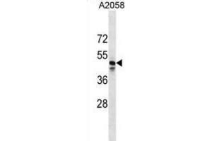 Western Blotting (WB) image for anti-MAS-Related GPR, Member F (Mrgprf) antibody (ABIN3000137) (Mrgprf antibody)