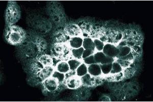 Immunofluorescence staining of A431 cells (ALOX5 antibody  (AA 442-590))