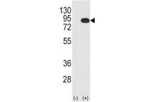 Western blot analysis B-RAF antibody and 293 cell lysate (2 ug/lane) either nontransfected (Lane 1) or transiently transfected with the BRAF gene (2). (BRAF antibody  (AA 379-408))