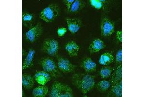 IF analysis of DGCR8 using anti-DGCR8 antibody (ABIN5692841). (DGCR8 antibody  (AA 561-762))