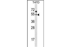 Western blot analysis in T47D cell line lysates (35ug/lane). (ZDHHC6 antibody  (C-Term))