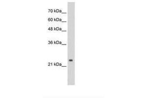 Image no. 1 for anti-Cleavage and Polyadenylation Specific Factor 4, 30kDa (CPSF4) (C-Term) antibody (ABIN6736285) (CPSF4 antibody  (C-Term))