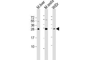 All lanes : Anti-CDX1 Antibody (C-term) at 1:1000-1:2000 dilution Lane 1: mouse liver lysate Lane 2: mouse testis lysate Lane 3: WiDr whole cell lysate Lysates/proteins at 20 μg per lane. (CDX1 antibody)