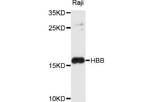 Western blot analysis of extracts of Raji cells, using HBB antibody (ABIN4903870) at 1:1000 dilution. (Hemoglobin Subunit beta antibody)