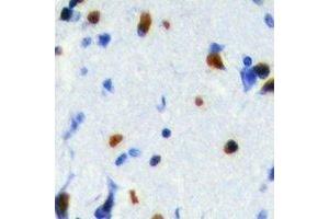 Immunohistochemical analysis of SRSF5 staining in human brain formalin fixed paraffin embedded tissue section. (SRSF5 antibody)