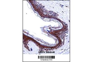 Immunohistochemistry (IHC) image for anti-SWI/SNF Related, Matrix Associated, Actin Dependent Regulator of Chromatin, Subfamily E, Member 1 (SMARCE1) (AA 307-335), (C-Term) antibody (ABIN5530477)