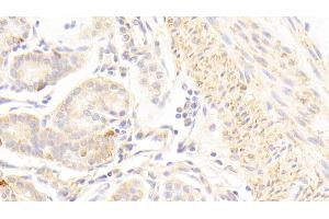 Detection of GRM1 in Human Stomach Tissue using Polyclonal Antibody to Glutamate Receptor, Metabotropic 1 (GRM1) (Metabotropic Glutamate Receptor 1 antibody  (AA 165-592))