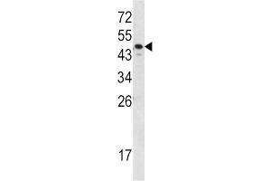 Western Blotting (WB) image for anti-Serpin Family A Member 7 (SERPINA7) antibody (ABIN3002767) (SERPINA7 antibody)