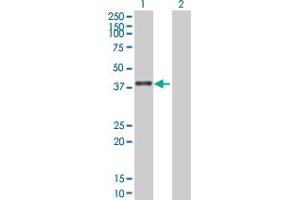 Western Blot analysis of ZNF783 expression in transfected 293T cell line by ZNF783 MaxPab polyclonal antibody. (ZNF783 antibody  (AA 1-281))