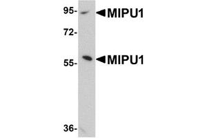 Western Blotting (WB) image for anti-Zinc Finger Protein 667 (ZNF667) (N-Term) antibody (ABIN1031458)