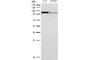 All lanes use the Antibody at 1:1K dilution for 1 hour at room temperature. (Recombinant PRMT7 antibody)