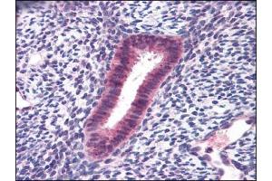 Human Uterus: Formalin-Fixed, Paraffin-Embedded (FFPE) (FOXN1 antibody)