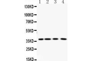 PNP antibody  (Middle Region)