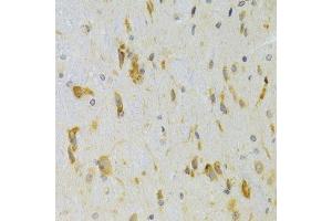Immunohistochemistry of paraffin-embedded rat spinal cord using SCO2 Antibody. (SCO2 antibody  (AA 1-130))