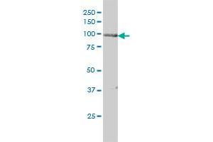 PRKD2 monoclonal antibody (M01), clone 2E4 Western Blot analysis of PRKD2 expression in HeLa . (PKD2 antibody  (AA 1-110))