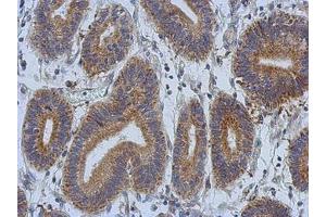 Image no. 1 for anti-Discoidin, CUB and LCCL Domain Containing 2 (DCBLD2) (AA 489-750) antibody (ABIN1497772) (DCBLD2 antibody  (AA 489-750))
