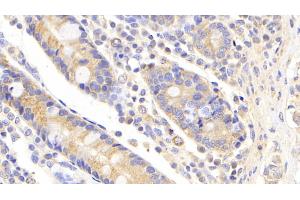 Detection of UBE2S in Human Small intestine Tissue using Polyclonal Antibody to Ubiquitin Conjugating Enzyme E2S (UBE2S) (UBE2S antibody  (AA 1-209))
