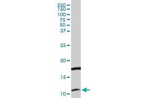 CXCL11 MaxPab rabbit polyclonal antibody. (CXCL11 antibody  (AA 1-94))
