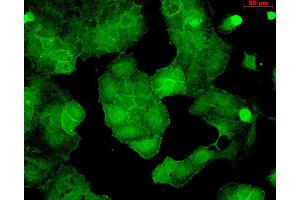 Immunocytochemistry/Immunofluorescence analysis using Mouse Anti-PSD95 Monoclonal Antibody, Clone 6G6 . (DLG4 antibody  (Atto 488))