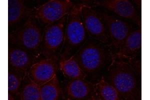 Immunofluorescence staining of methanol-fixed MCF cells using IGF-1R(Phospho-Tyr1165/Tyr1166) Antibody. (IGF1R antibody  (pTyr1165, pTyr1166))
