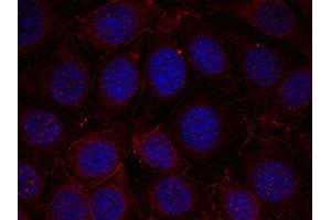 Immunofluorescence staining of methanol-fixed MCF cells using IGF-1R(Phospho-Tyr1165/Tyr1166) Antibody. (IGF1R antibody  (pTyr1165, pTyr1166))